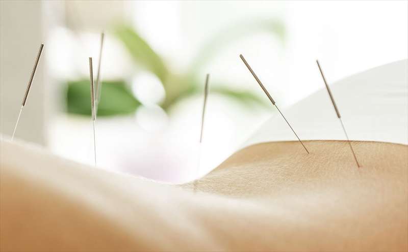 痛みやしびれの緩和を図る鍼灸施術を安心価格で浦添市で実施